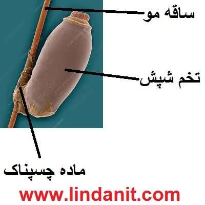 چگونه رشک را از بین ببریم